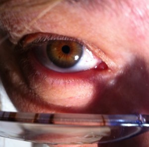 Day 1 eye